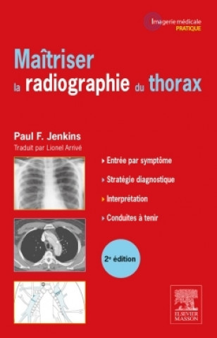 Könyv Maîtriser la radiographie du thorax Paul F. Jenkins