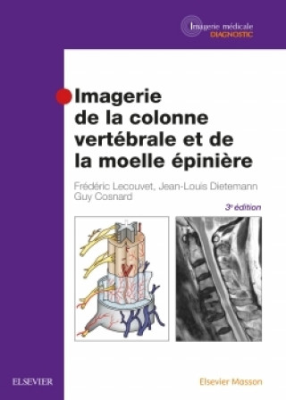 Knjiga Imagerie de la colonne vertébrale et de la moelle épinière Frédéric Lecouvet