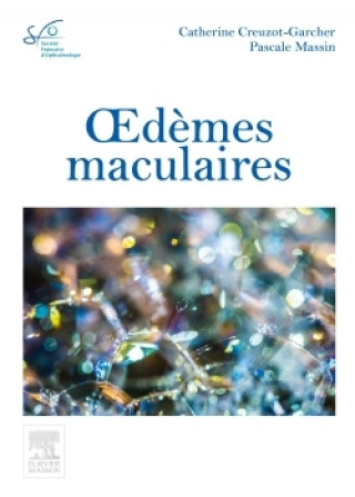 Kniha Oedèmes maculaires Catherine Creuzot-Garcher