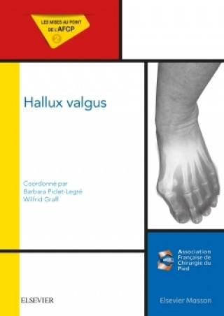 Книга Hallux valgus Docteur Barbara Piclet-Legré
