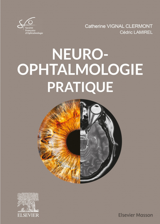 Carte Neuro-ophtalmologie pratique Professeur Catherine Vignal-Clermont