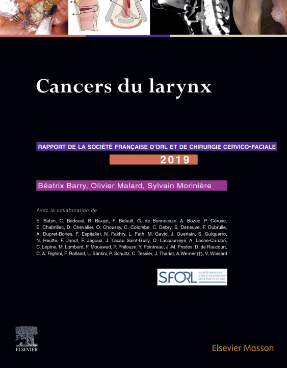 Kniha Cancers du larynx Olivier Malard