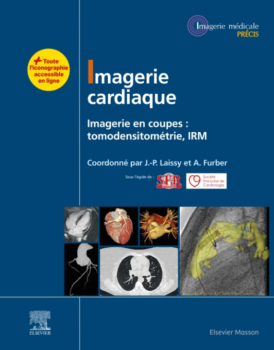 Книга Imagerie cardiaque Jean-Pierre Laissy
