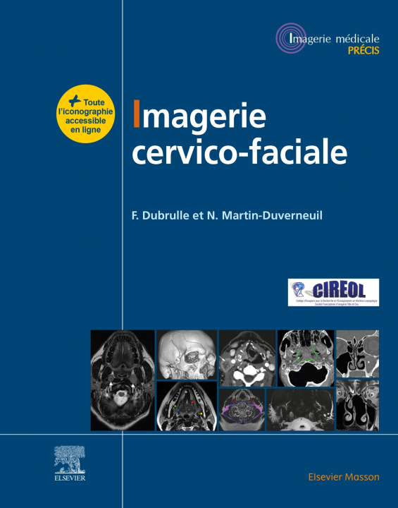 Kniha Imagerie cervicofaciale Frédérique Dubrulle