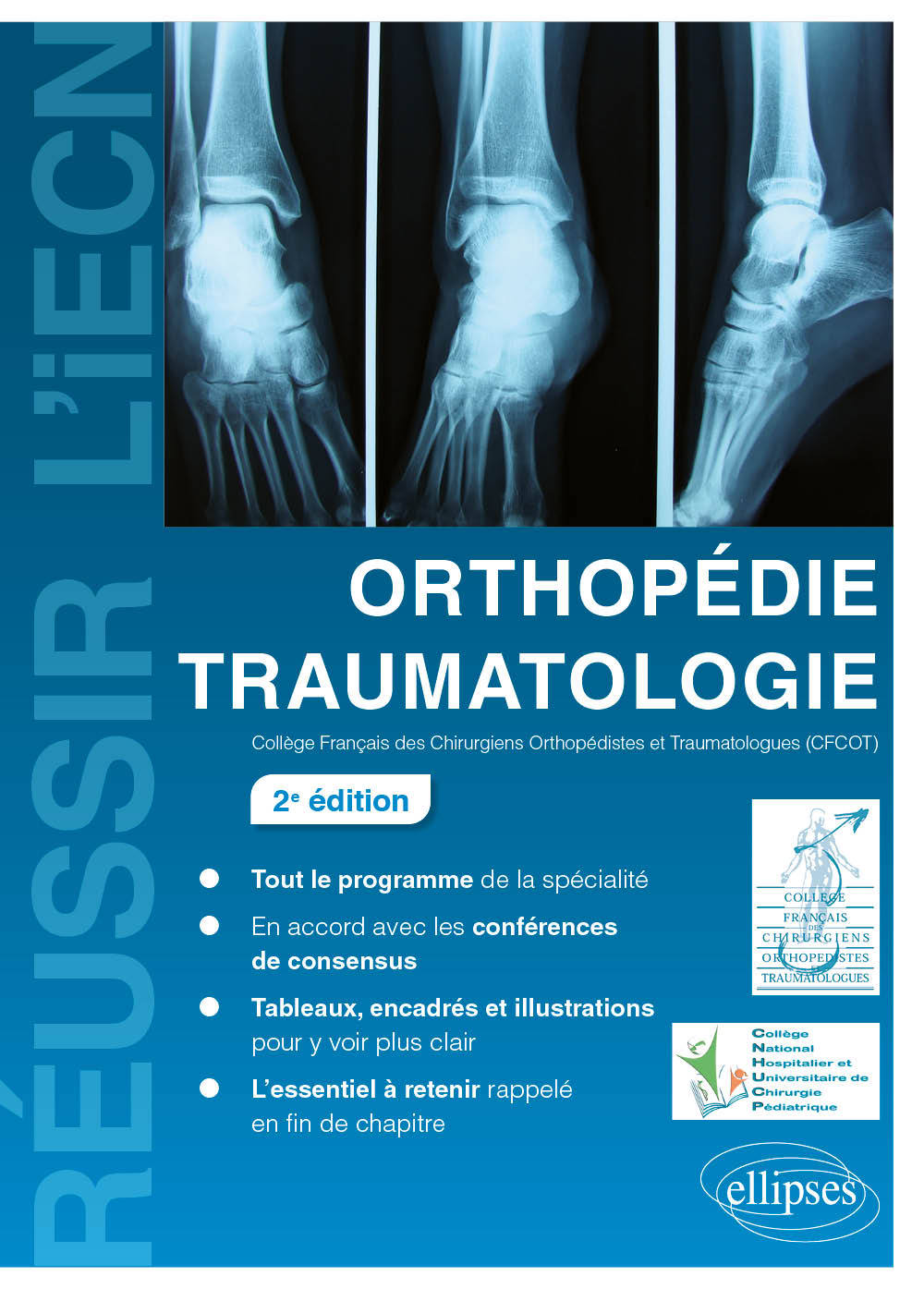 Kniha Orthopédie Traumatologie - 2e édition Collège Français des Chirurgiens Orthopédistes et Traumatologues