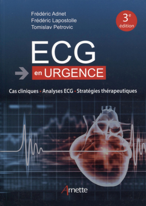 Книга ECG en urgence Petrovic