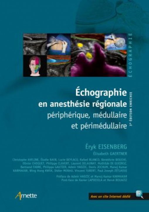 Carte Echographie en anesthésie régionale Gaertner