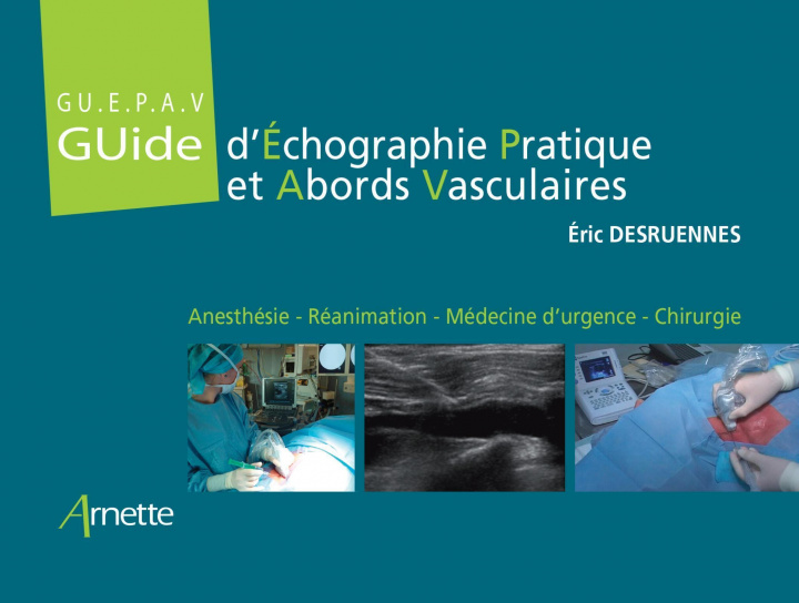 Книга Guide d'Échographie Pratique et Abords Vasculaires (GU.E.P.A.V) Desruennes