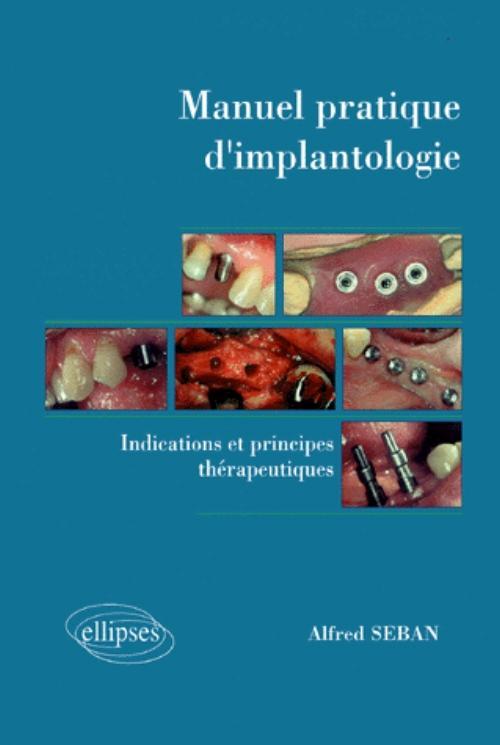Carte Manuel pratique d'implantologie - Indications et principes thérapeutiques Seban