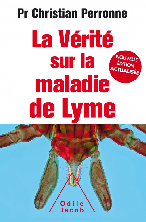 Kniha La Vérité sur  la maladie de Lyme -NE Augmentée Christian Perronne