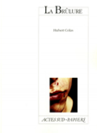 Buch Brulure (la) Colas