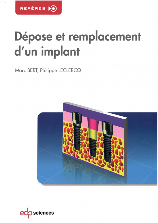 Kniha DEPOSE ET REMPLACEMENT D'UN IMPLANT BERT