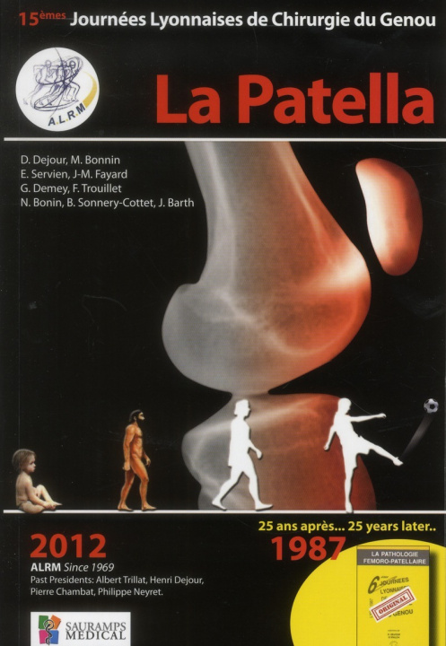 Knjiga LA PATELLA - ALRM DEJOUR D &COLL