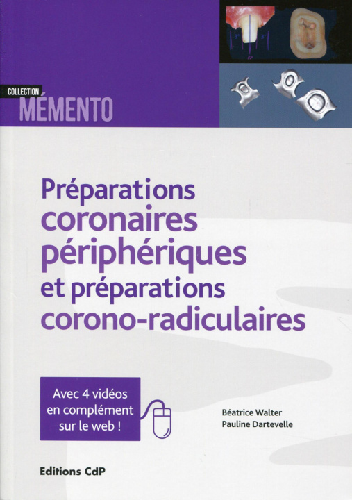 Könyv Les préparations coronaires périphériques et préparations corono-radiculaires Dartevelle