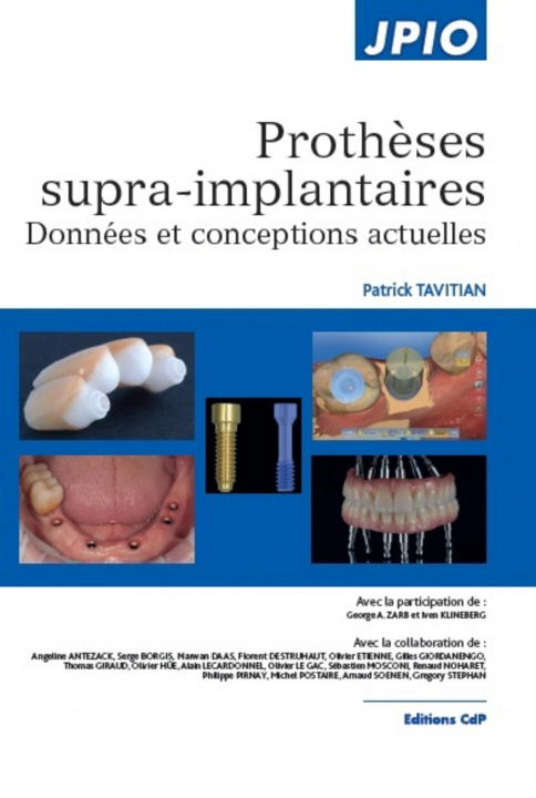 Könyv Prothèses supra-implantaires Klineberg