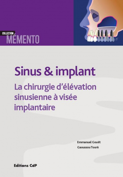 Knjiga Sinus et implants Touré