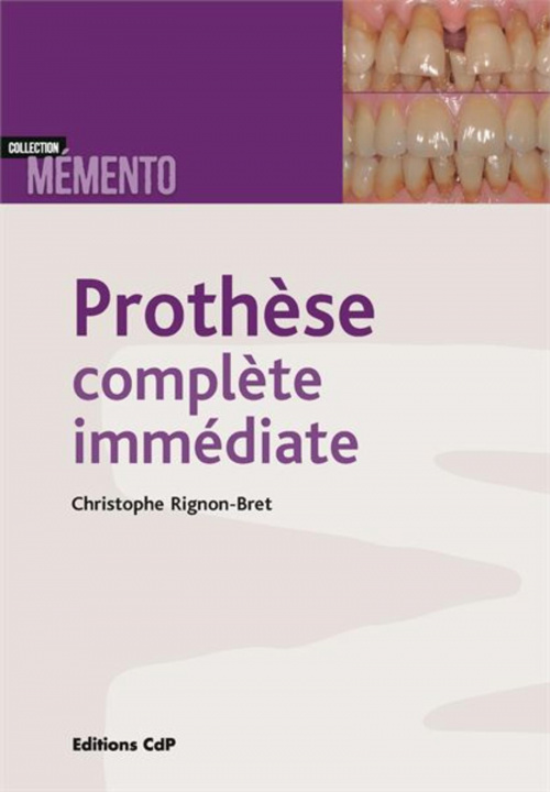 Knjiga Prothèse complète immédiate Rignon-Bret