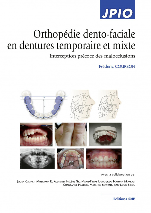 Könyv Orthopédie dento-faciale en dentures temporaire et mixte Courson