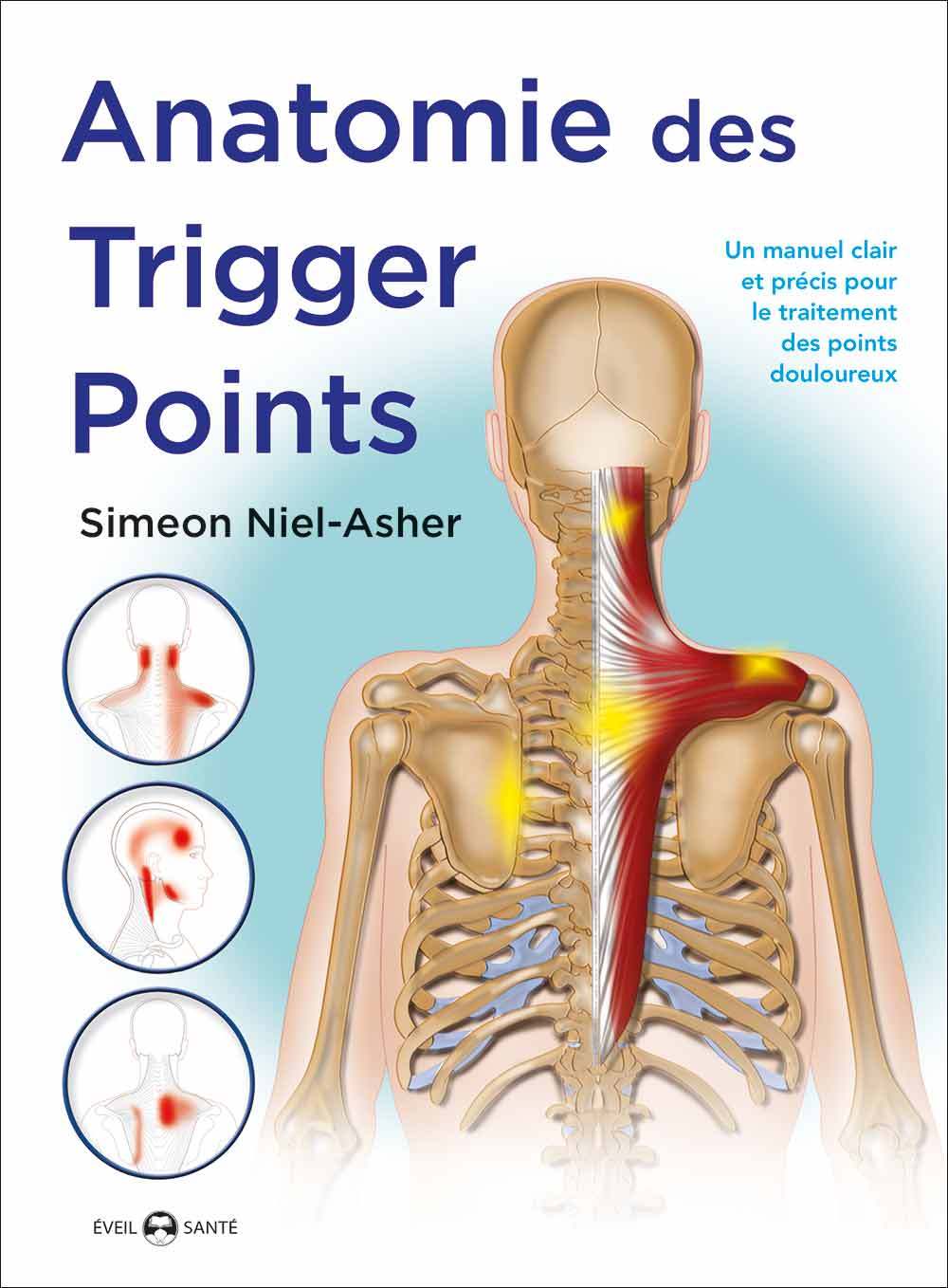 Carte Anatomie des trigger points NIEL-ASHER