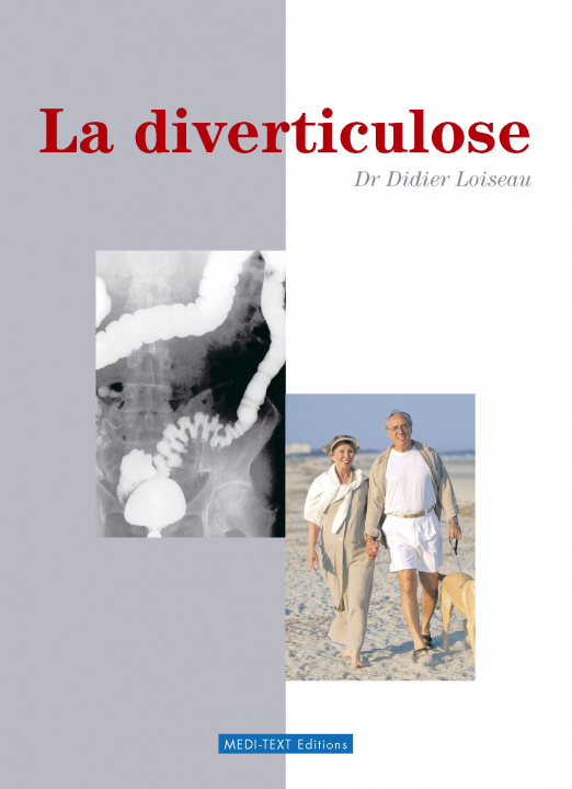 Knjiga LA DIVERTICULOSE DIDIER