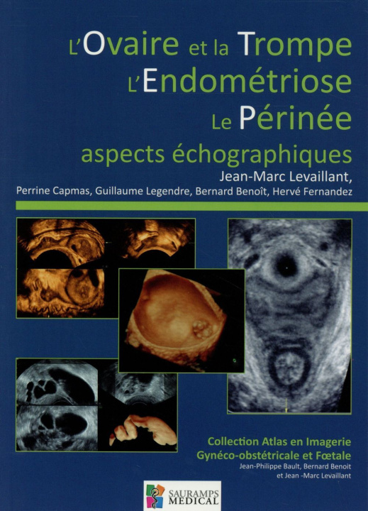 Книга L OVAIRE ET LA TROMPE-L ENDOMETRIOSE-LE PERINEE-ASPECTS ECHOGRAPHIQUES BENOIT B & COLL