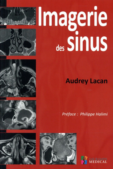 Kniha IMAGERIE DES SINUS Lacan