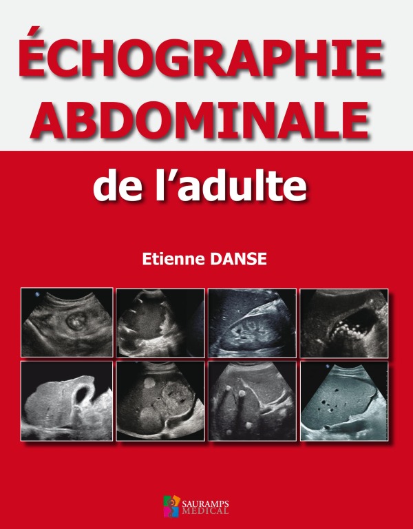 Könyv ECHOGRAPHIE ABDOMINALE DE L ADULTE DANSE ETIENNE