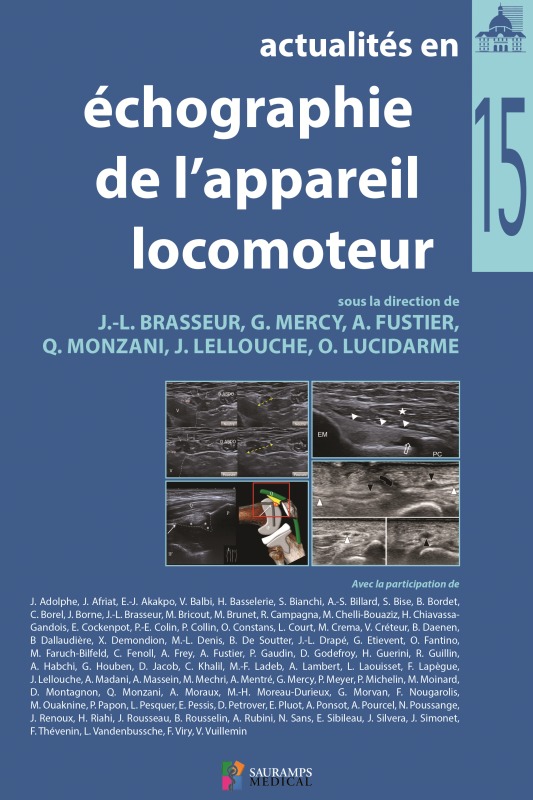 Kniha ACTUALITES EN ECHOGRAPHIE DE L APPAREIL LOCOMOTEUR T 15 BRASSEUR/MERCY & COLL