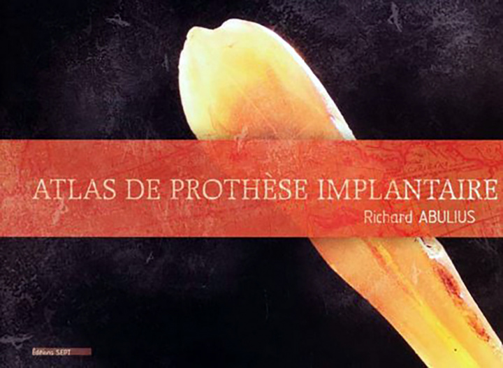 Knjiga ATLAS DE PROTHESE IMPLANTAIRE ABULIUS