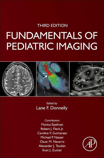 Könyv Fundamentals of Pediatric Imaging 