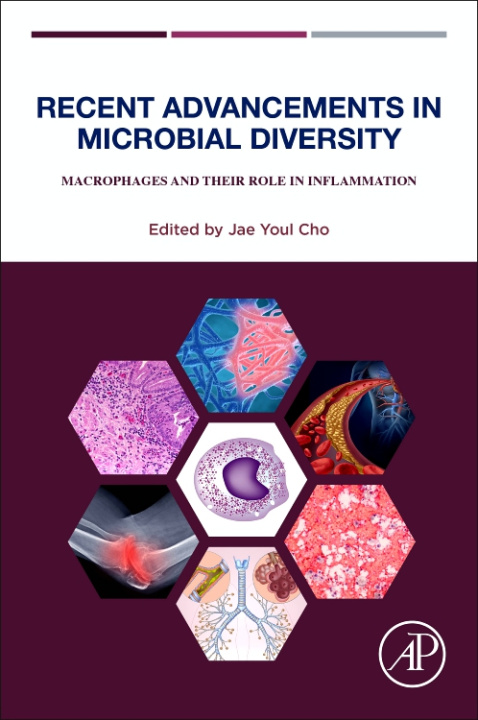 Carte Recent Advancements in Microbial Diversity: Macrophages and Their Role in Inflammation 
