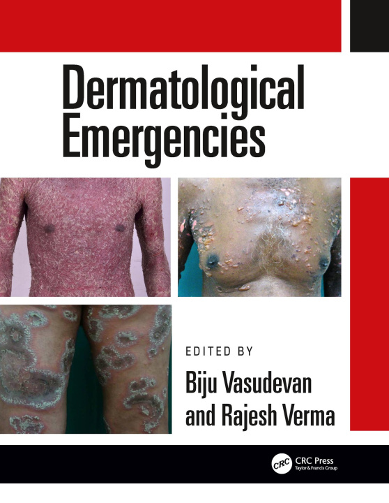 Boek Dermatological Emergencies Biju Vasudevan
