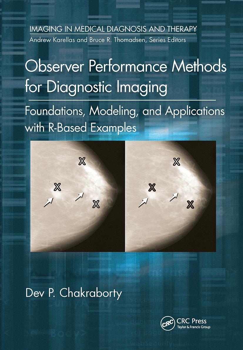 Knjiga Observer Performance Methods for Diagnostic Imaging Dev P. Chakraborty