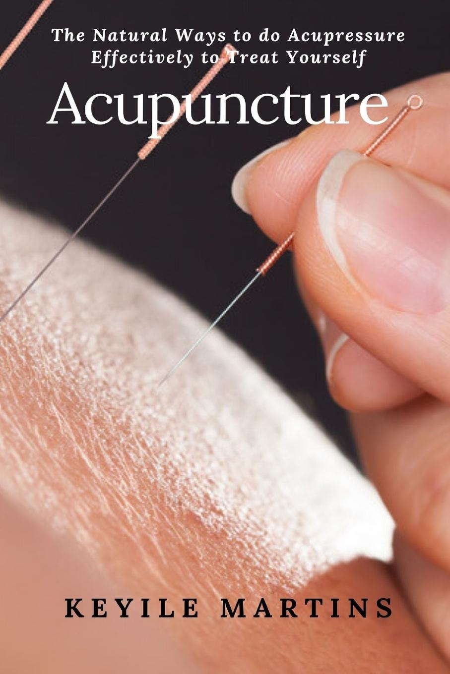 Kniha Acupuncture 