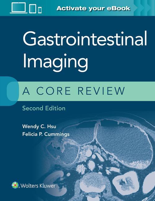 Kniha Gastrointestinal Imaging: A Core Review 