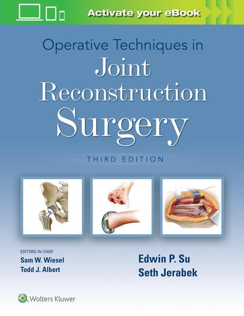 Könyv Operative Techniques in Joint Reconstruction Surgery SU