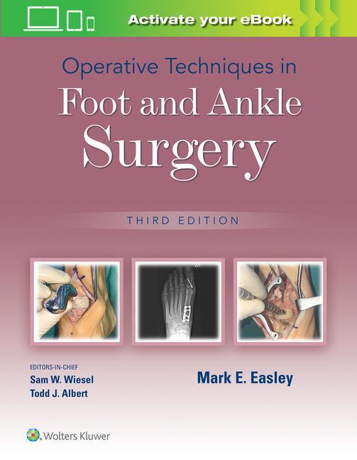 Kniha Operative Techniques in Foot and Ankle Surgery EASLEY
