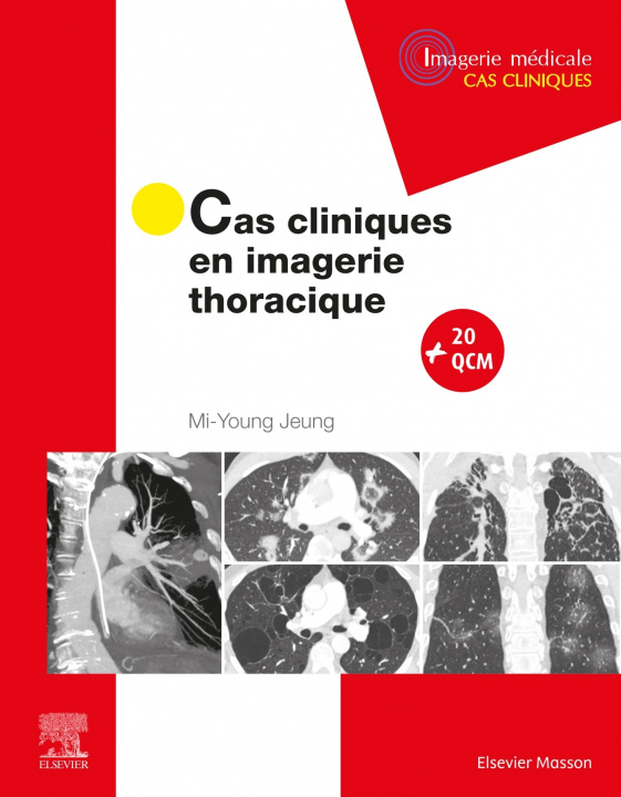 Книга Cas cliniques en imagerie thoracique Mi-Young Jeung