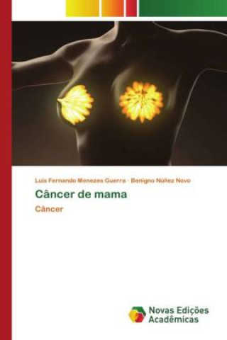 Kniha Cancer de mama Benigno Nú?ez Novo