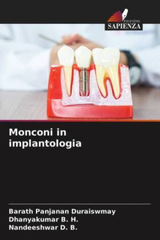 Carte Monconi in implantologia Dhanyakumar B. H.