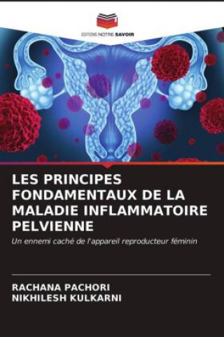 Carte Les Principes Fondamentaux de la Maladie Inflammatoire Pelvienne Nikhilesh Kulkarni