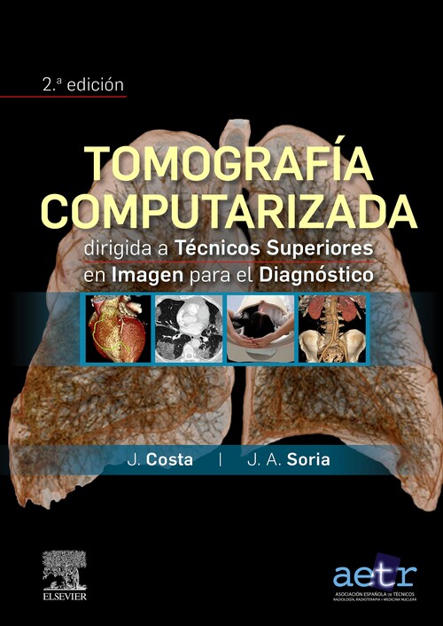 Kniha Tomografía computarizada dirigida a técnicos superiores en imagen para el diagnó J. COSTA