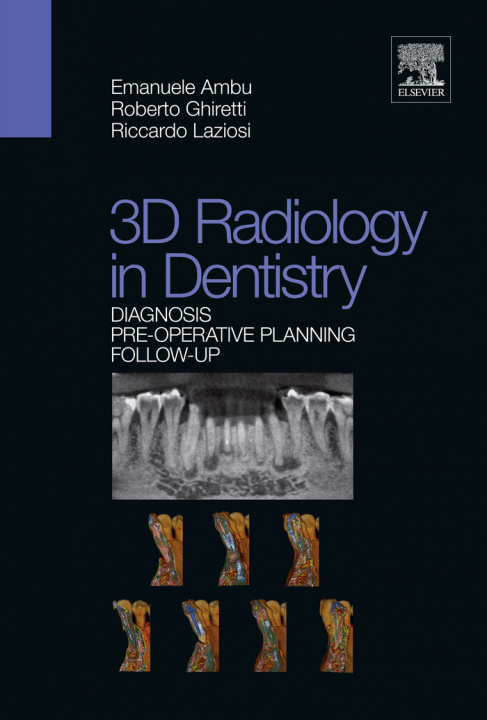 Kniha 3D RADIOLOGY IN DENTISTRY DIAGNOSIS PREO EMANUELE AMBU