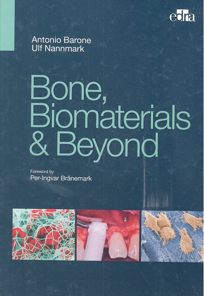 Buch BONE BIOMATERIALS BEYOND ANTONIO BARONE