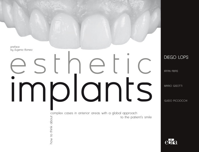 Carte ESTHETIC IMPLANTS HOW TO THINK ABOUT COM DIEGO LOPS