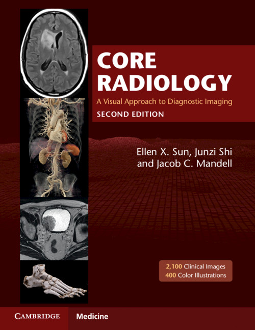 Книга Core Radiology Ellen X. Sun