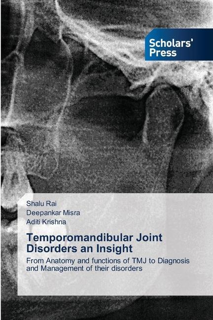 Kniha Temporomandibular Joint Disorders an Insight Deepankar Misra