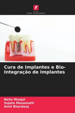 Kniha Cura de Implantes e Bio- Integracao de Implantes Sujata Masamatti