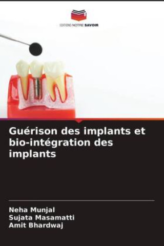 Kniha Guerison des implants et bio-integration des implants Sujata Masamatti