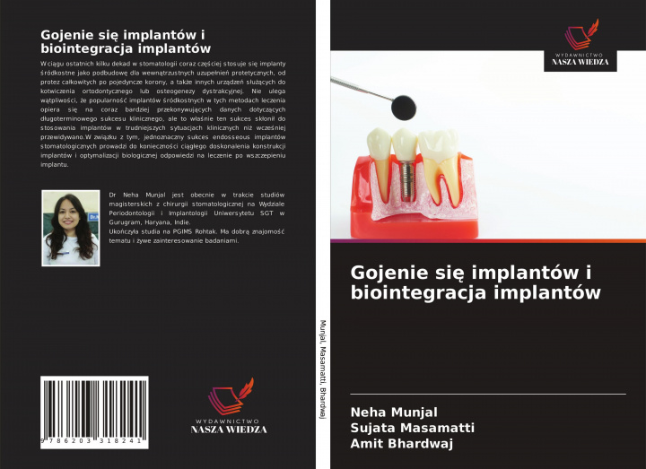 Kniha Gojenie si&#281; implantow i biointegracja implantow Sujata Masamatti